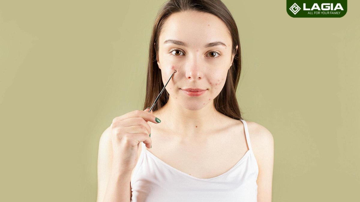 Mụn Mãi Không Hết? Có Thể Bạn Đang Bỏ Quên Yếu Tố Quan Trọng Này